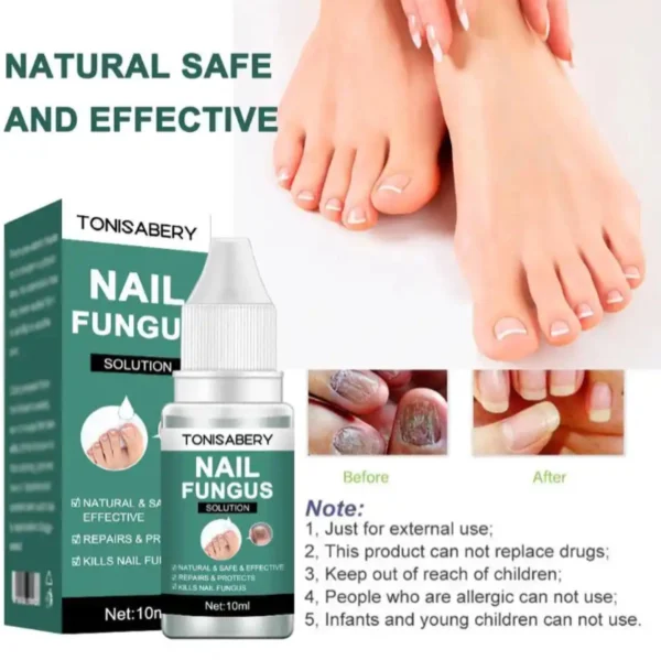 Tonisabery Nail Fungus - Image 3